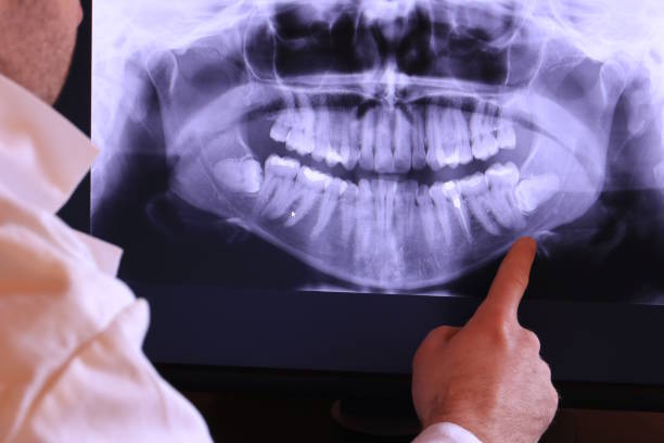 Best Affordable Emergency Dental Care  in Park Rapids, MN