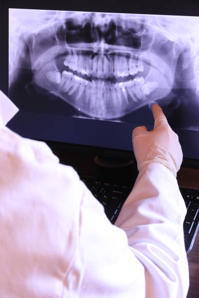 Best Broken Tooth Emergency  in Park Rapids, MN