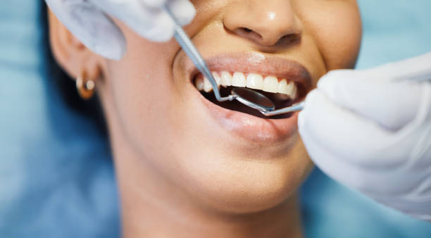 Best Teeth Whitening  in Park Rapids, MN